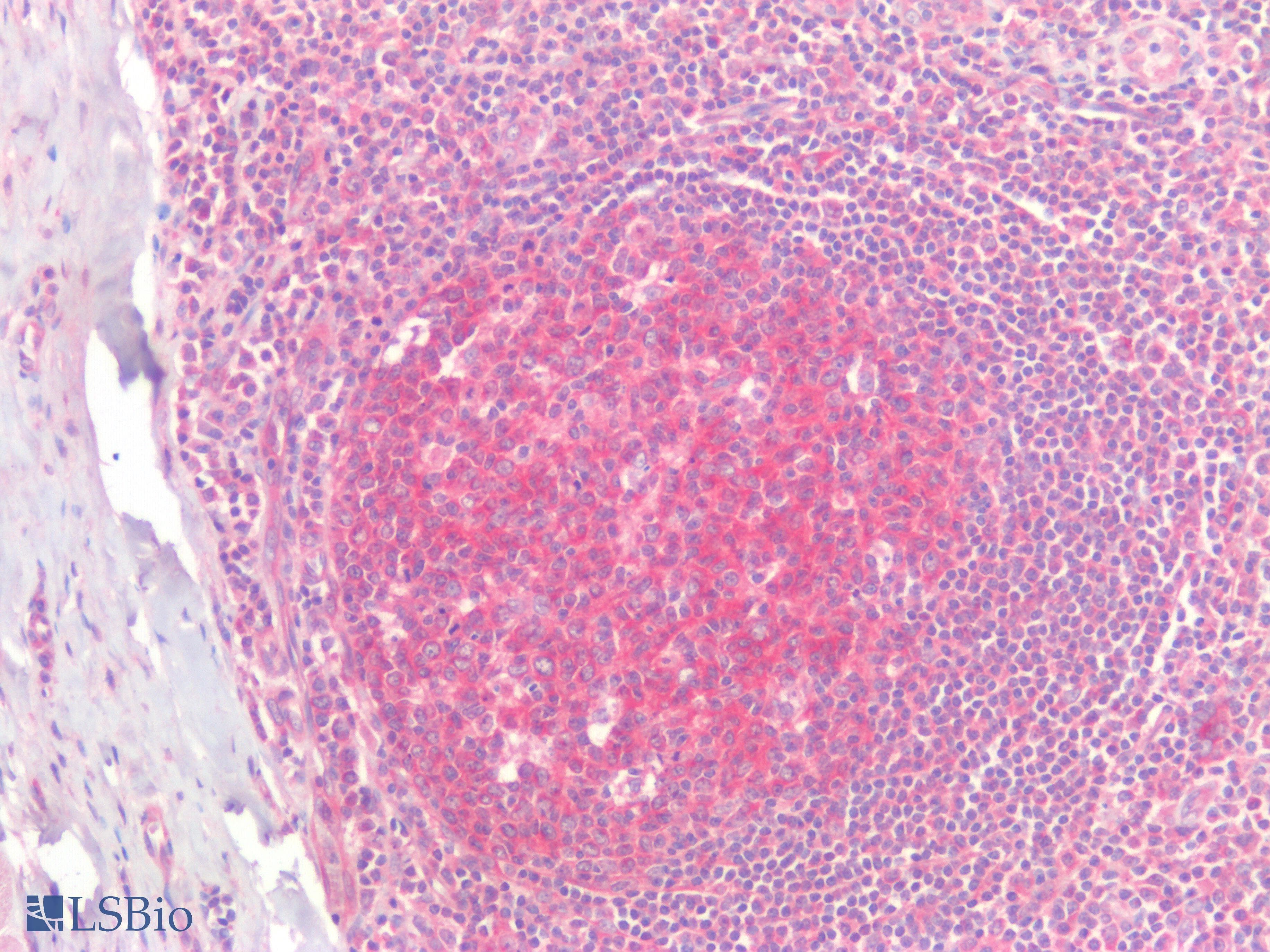 IHC-plus™ PD-L2 / PDCD1LG2 / CD273 Antibody