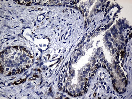 Monoclonal Mouse anti-Human R1 / RRM1 Antibody (clone OTI6G8, aa541-792, IHC, WB)