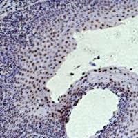 HIST1H3H Antibody