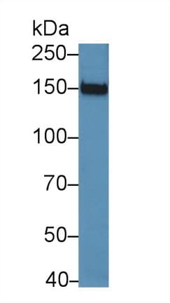 JAG2 / Jagged-2 Antibody (aa709-941)