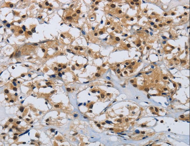 CMTM8 Antibody
