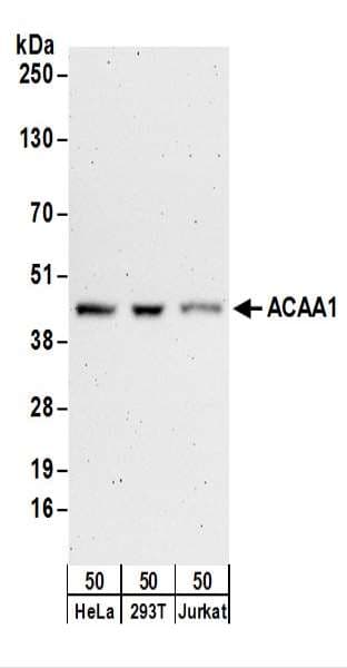 ACAA1 Antibody (aa50-100)