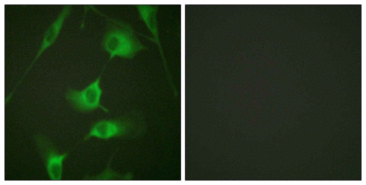KRT8 / CK8 / Cytokeratin 8 Antibody (p431)