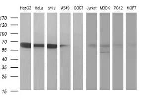 MAdCAM-1 Antibody (clone OTI1B7)