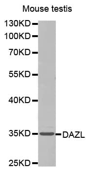 Polyclonal Rabbit anti-Human DAZL Antibody (WB)