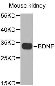 BDNF Antibody