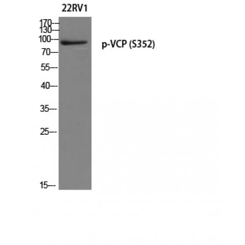 VCP Antibody (290-370 aa)