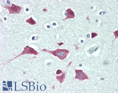 Polyclonal Rabbit anti-Human IRX1 Antibody (190-270 aa, Internal, IHC, IF, WB)