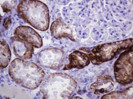 Monoclonal Mouse anti-Human CA12 / Carbonic Anhydrase XII Antibody (clone OTI2C6, IHC, WB)