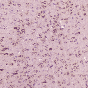 Polyclonal Rabbit anti-Mouse CALCA Antibody (IHC)