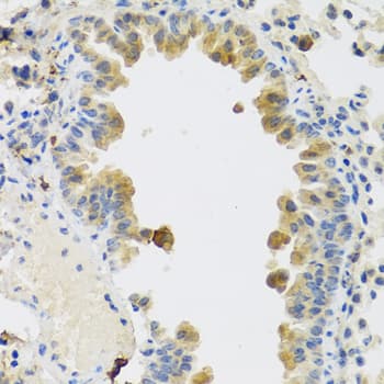 IHC-plus™ RSPO1 / RSPO Antibody