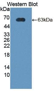 CRHBP Antibody (aa25-322)