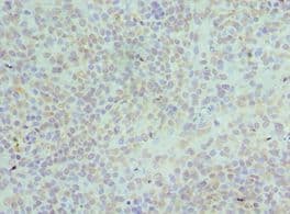HNRNPD / AUF1 Antibody (aa1-306)