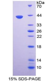 Mouse UCN / Urocortin Protein (Recombinant His-GST)
