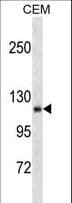 AMOT / Angiomotin Antibody (aa240-267)