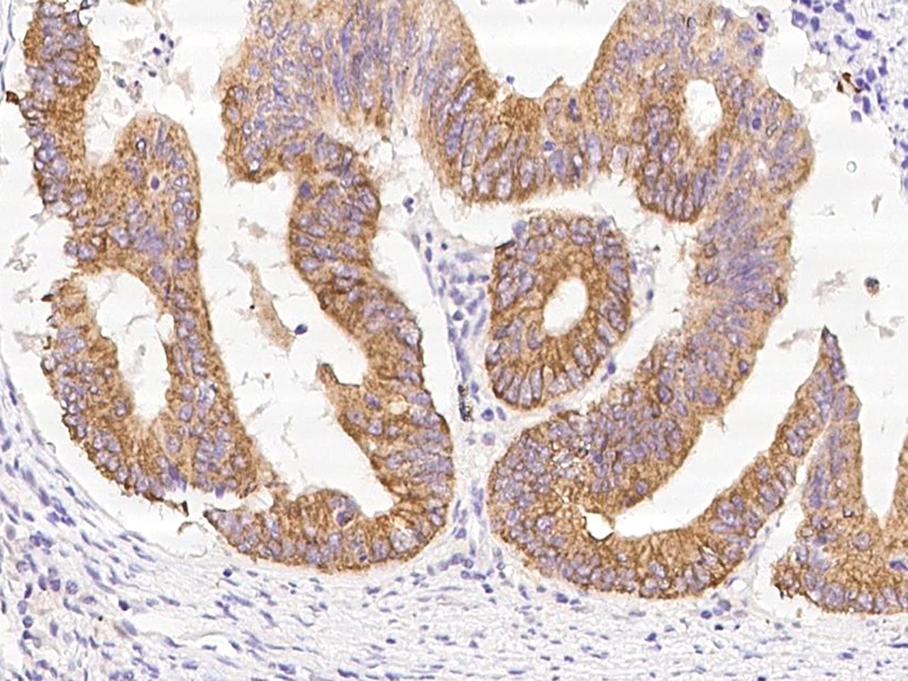 PPM1A / PP2CA Antibody (Preservative Free)