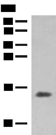 Hemoglobin Gamma (HBG1 + HBG2) Antibody