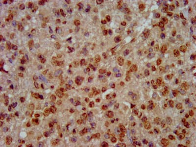 Polyclonal Rabbit anti-Human HIST1H3A Antibody (IHC)
