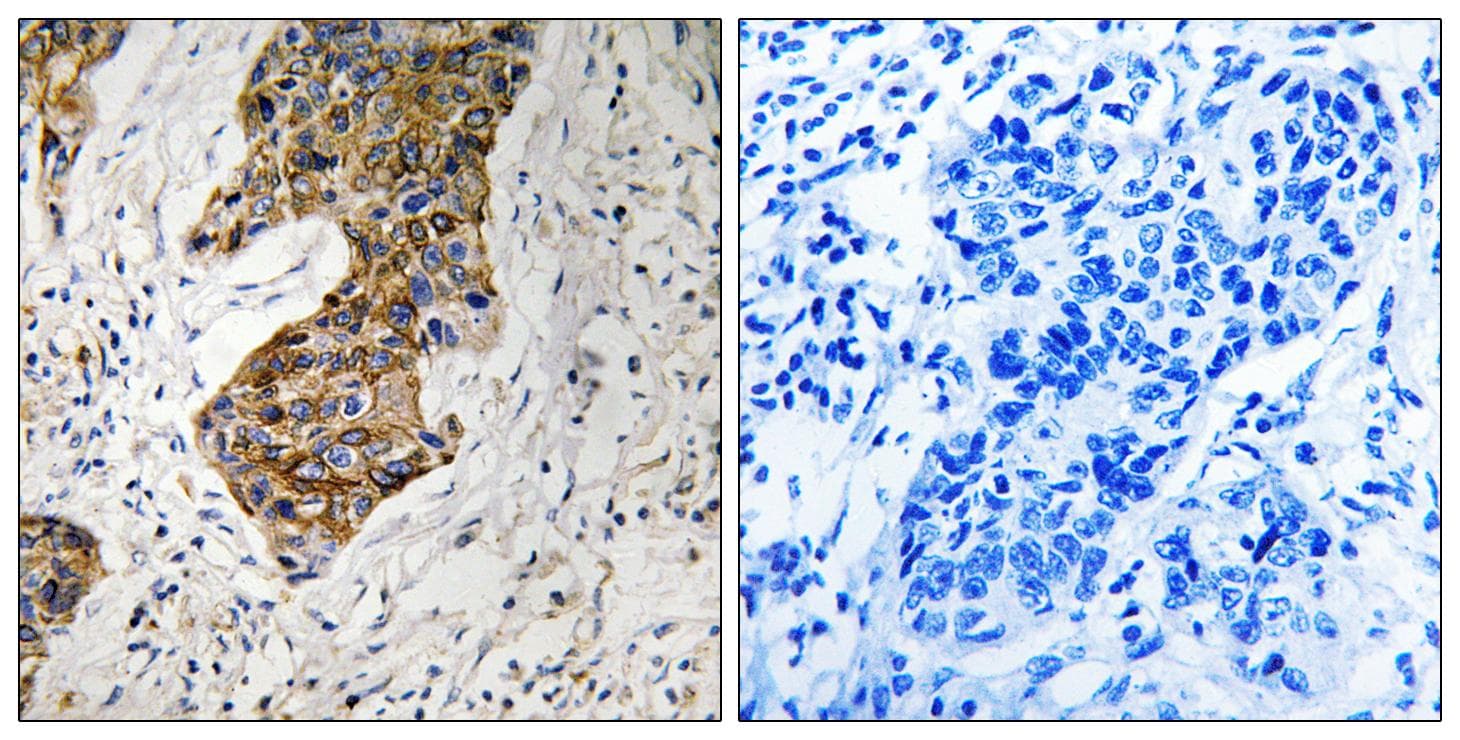 CBR / CBR1 Antibody