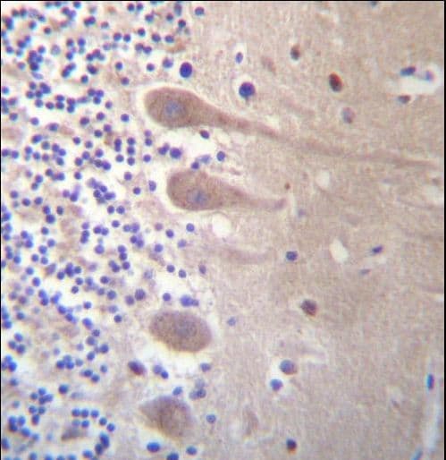 Polyclonal Rabbit anti-Human ZNF764 Antibody (aa84-113, IHC, WB)
