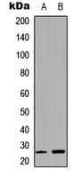 GJB7 / CX25 / Connexin 25 Antibody (Internal)