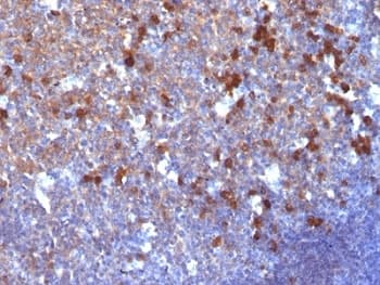 IgG Antibody (clone IG217)