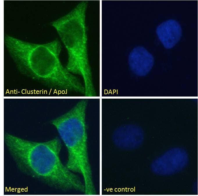 CLU / Clusterin Antibody (aa435-448)