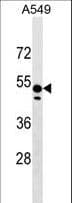 ZNF695 Antibody (aa244-269)