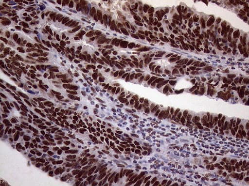 XRN2 Antibody (aa677-779, clone OTI5F4)
