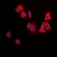 TPH1 / Tryptophan Hydroxylase Antibody (Internal)