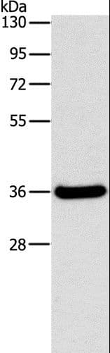 Polyclonal Rabbit anti-Human FGL1 / Hepassocin Antibody (IHC, WB)