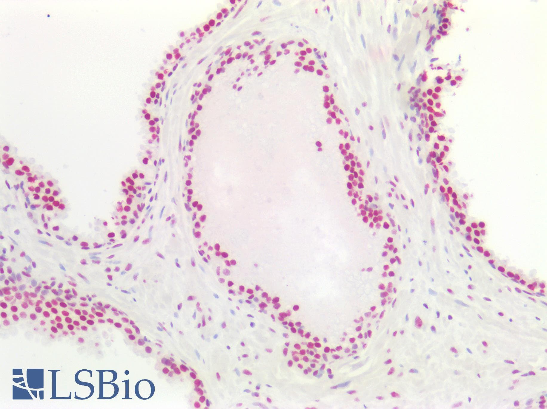 PathPlus™ Polyclonal Rabbit anti-Human CDK1 / CDC2 Antibody (aa121-170, IHC, WB)