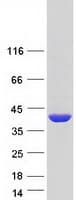 Human NAGK Protein (Recombinant Myc-DDK (Flag))