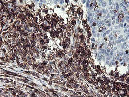 CD45 / LCA Antibody (clone OTI3F2)