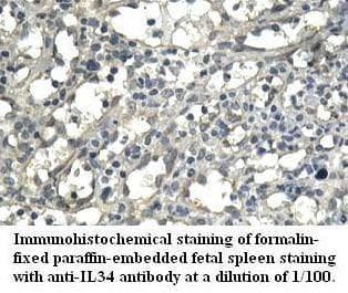 IL34 Antibody (aa21-242)