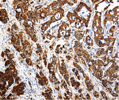 Polyclonal Rabbit anti-Human CTSE / Cathepsin E Antibody (IHC, IF, WB)
