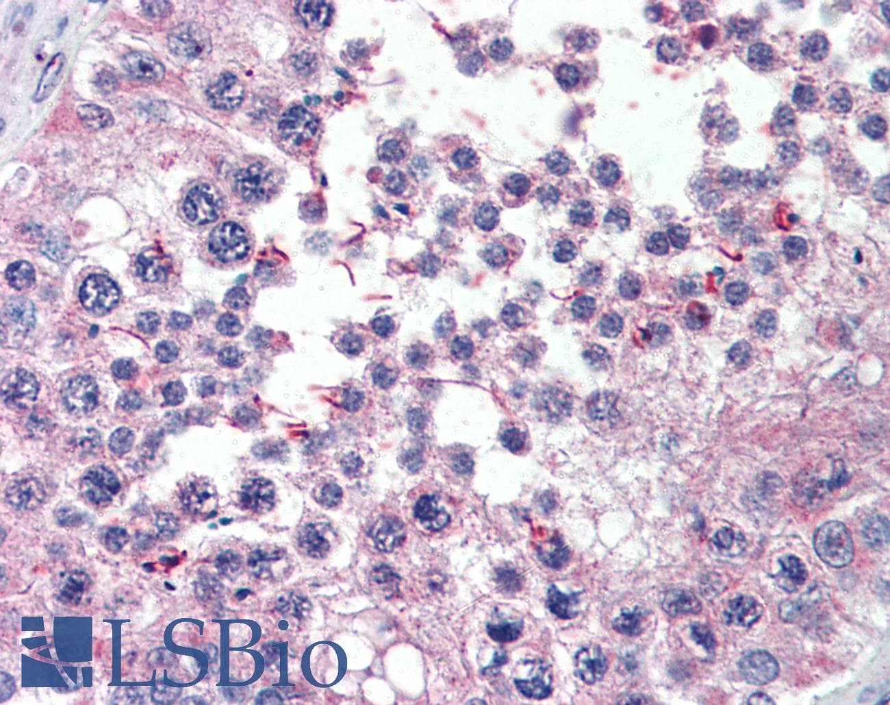IHC-plus™ Polyclonal Goat anti-Human XPO7 / RANBP16 Antibody (aa1075-1087, IHC, WB)