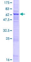 Human FUT6 Protein (Recombinant GST)