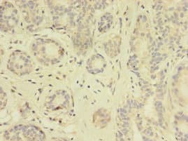 TK1 / TK / Thymidine Kinase Antibody (aa2-234)