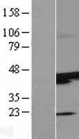 SUNC1 / SUN3 Protein (Over-Expression Lysate Myc-DDK (Flag))