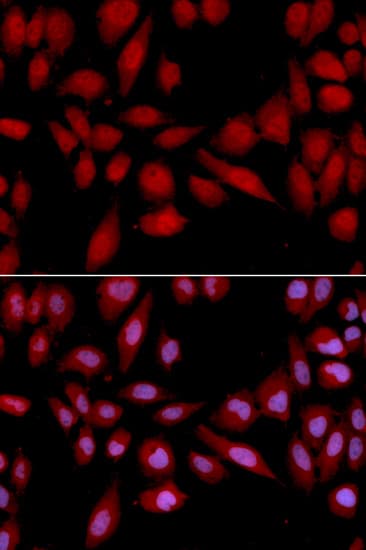 Polyclonal Rabbit anti-Human PSMA2 Antibody (IHC, IF, WB)