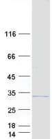 Human UNKL Protein (Recombinant Myc-DDK (Flag))