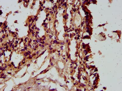 Polyclonal Rabbit anti-Human HECTD2 Antibody (IHC, IF)