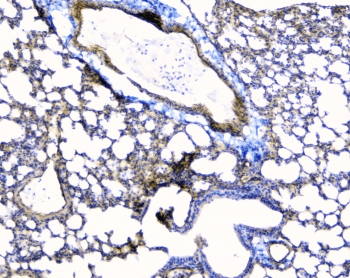 TEK / TIE2 Antibody