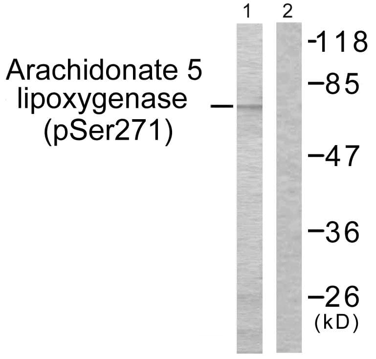 Polyclonal Rabbit anti-Human ALOX5 / 5-LOX Antibody (phospho-Ser271, IHC, WB)