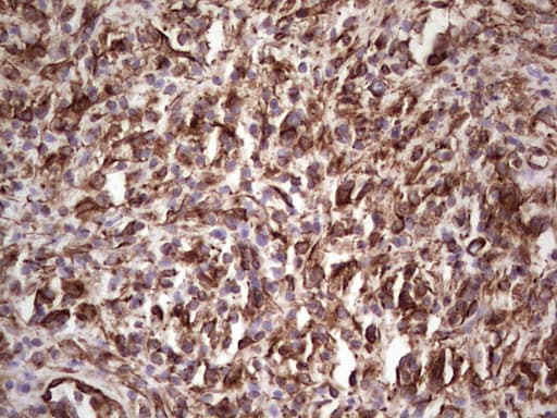 Peripherin Antibody (clone OTI1E10)