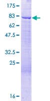 Human RBM42 Protein (Recombinant GST)
