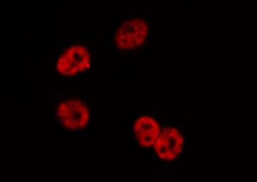 NFKBIB / IKB Beta / IKBB Antibody (phospho-Ser23)