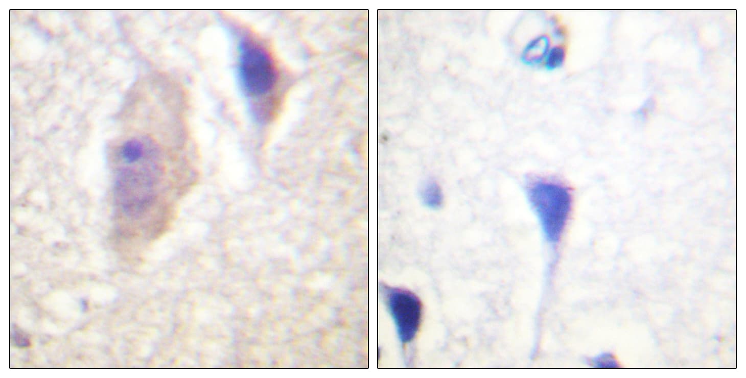 CML / BCR Antibody (phospho-Tyr360)