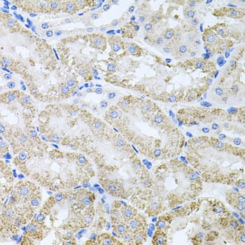 TARS Antibody